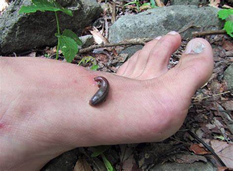 đỉa bám vào chân